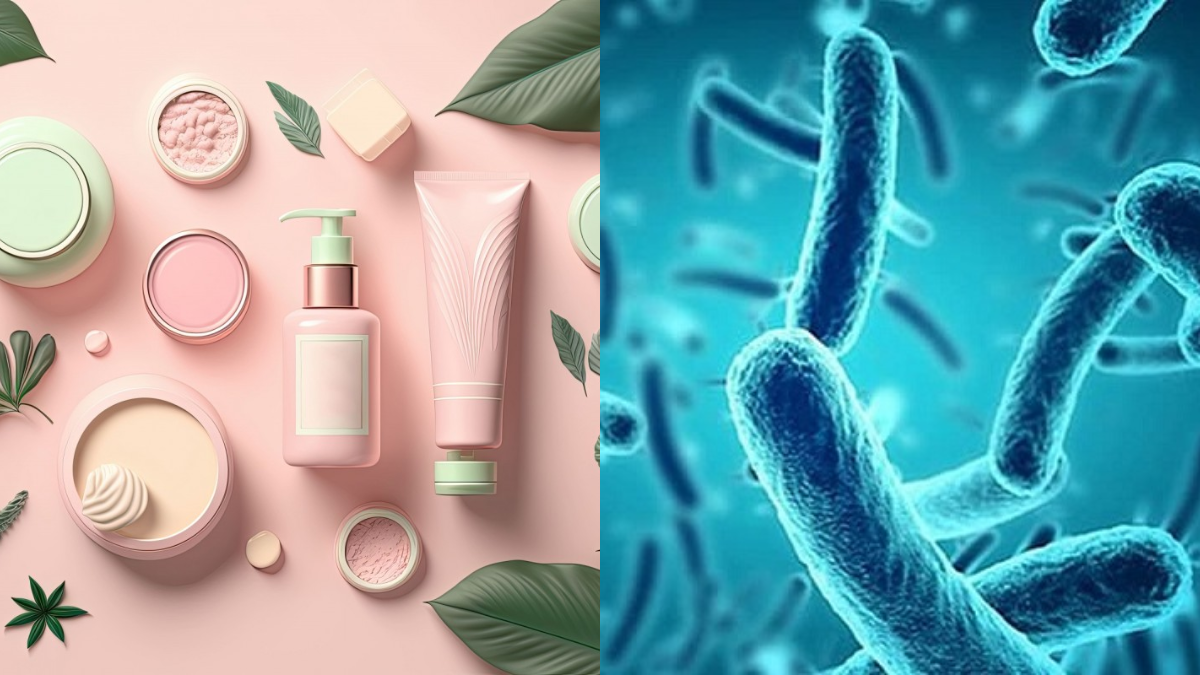 kiểm soát vi sinh